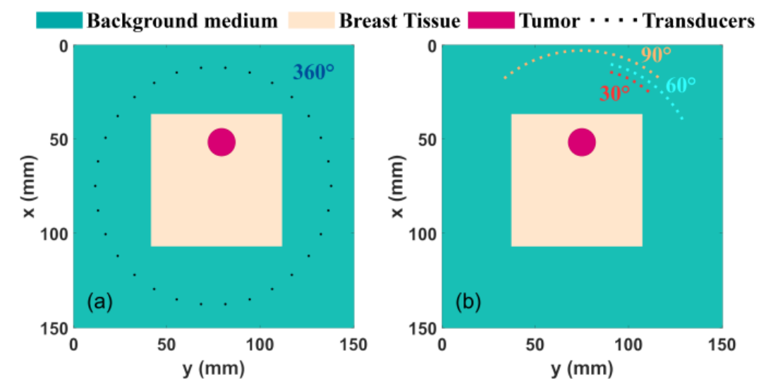 Deep-learning-enabled Microwave-induced Thermoacoustic Tomography based on Sparse Data for Breast Cancer Detection